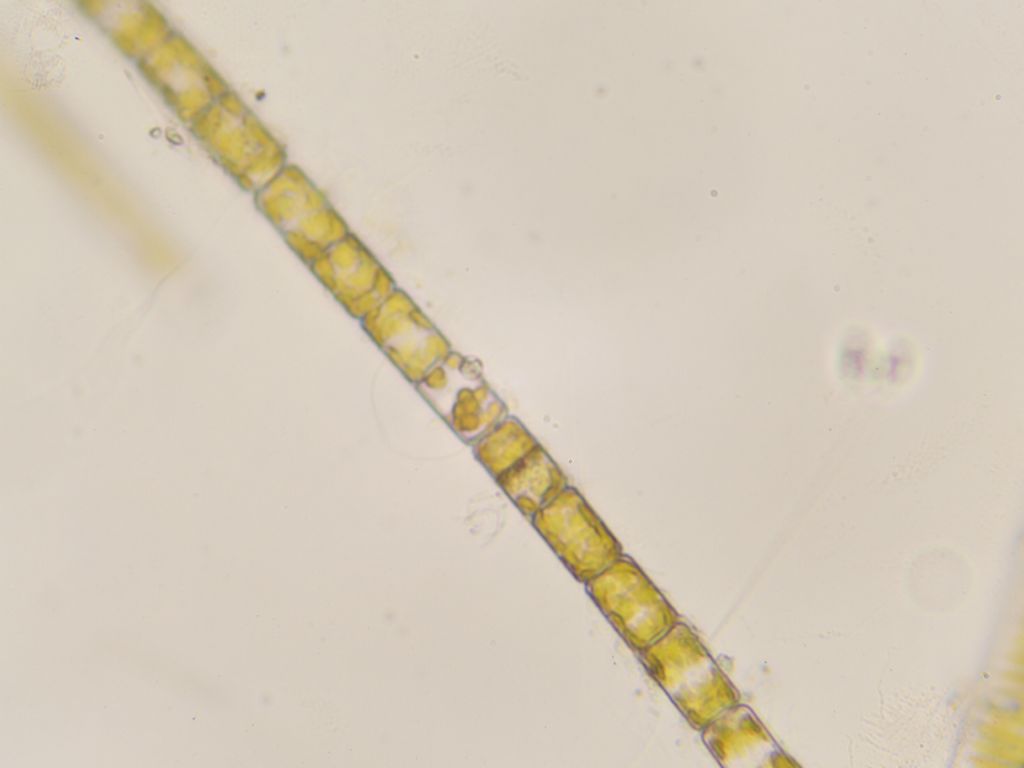 filamento alga con cisti